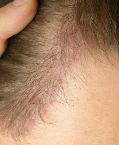 index.php/fa/5454/0/