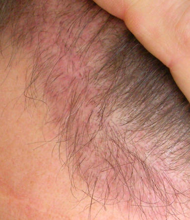 index.php/fa/5456/0/