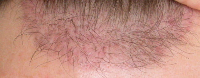 index.php/fa/5458/0/