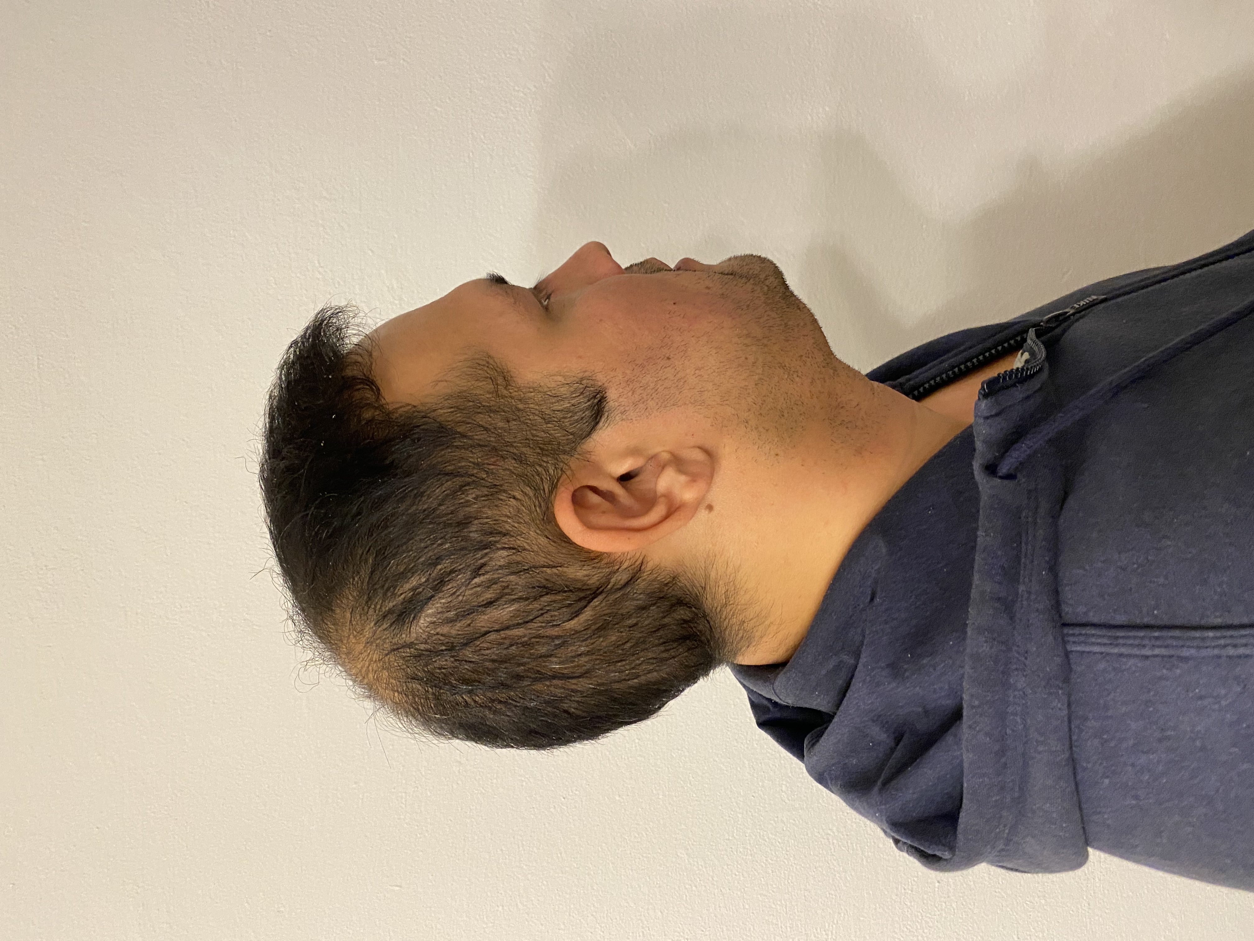 /foren/transplant/index.php/fa/54679/0/