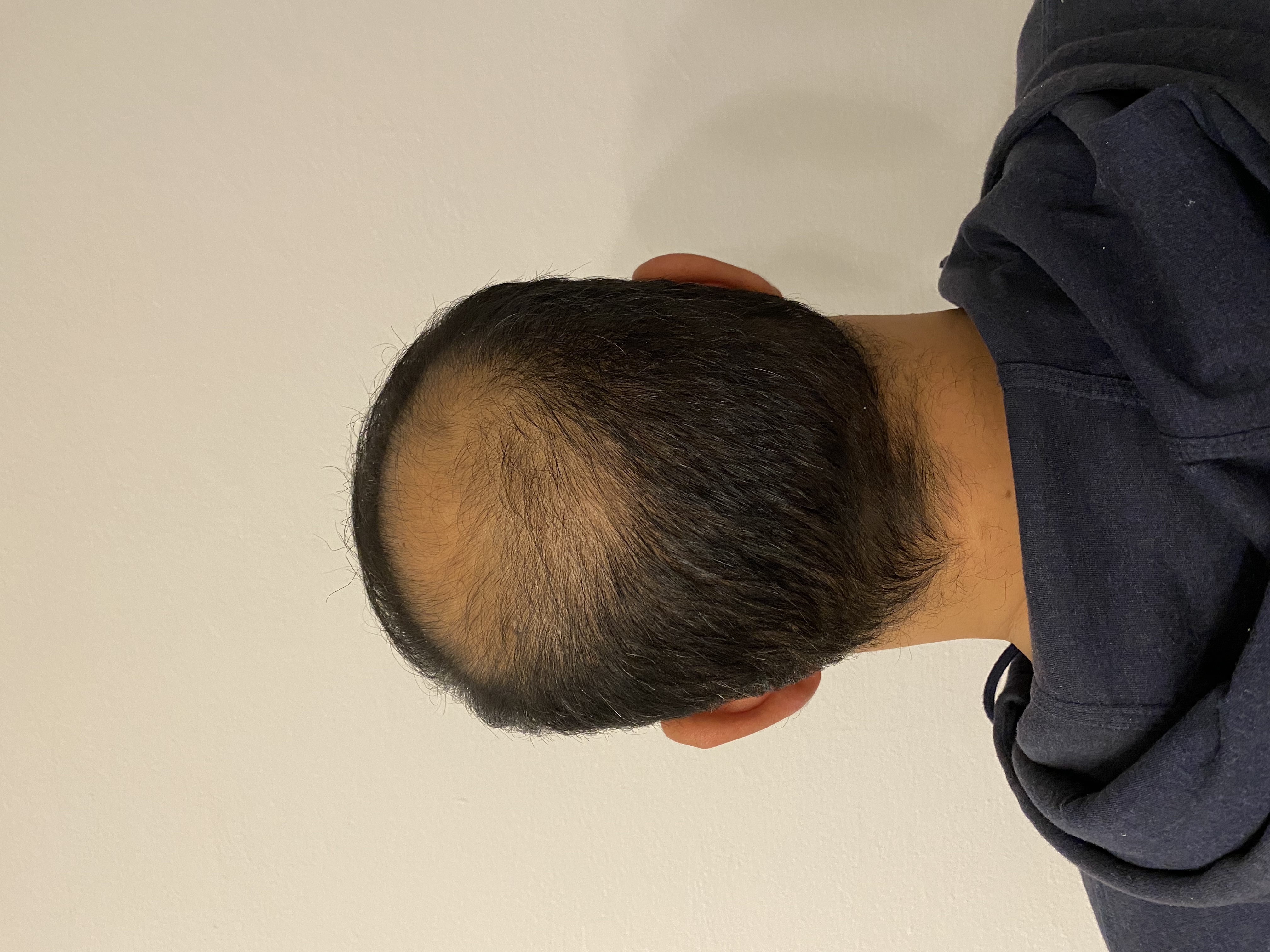 /foren/transplant/index.php/fa/54680/0/