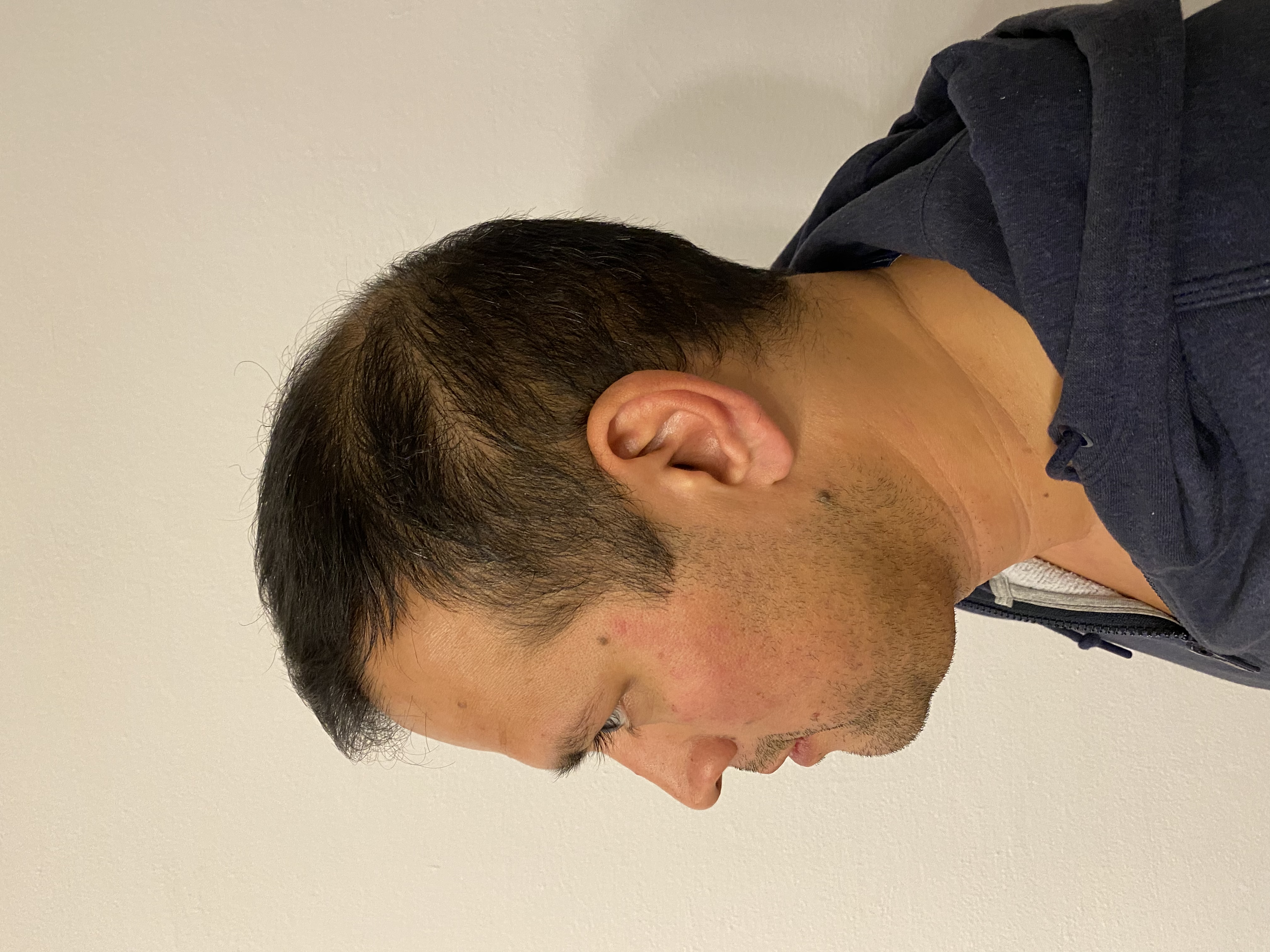 /foren/transplant/index.php/fa/54681/0/