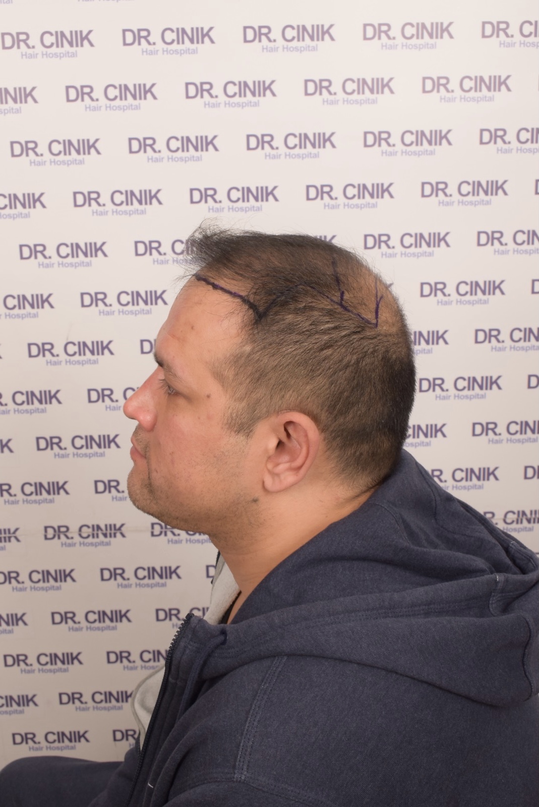 /foren/transplant/index.php/fa/54682/0/