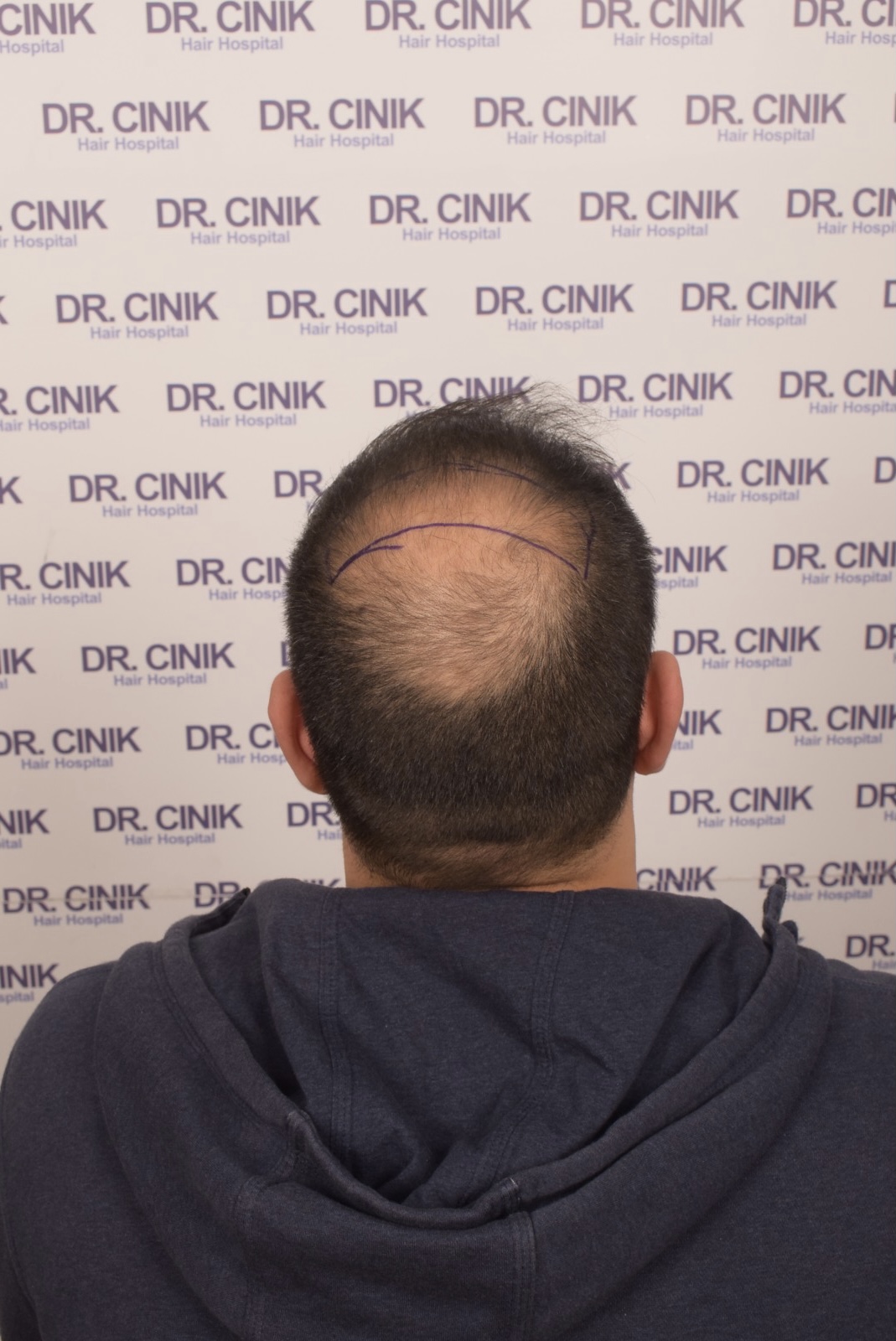 /foren/transplant/index.php/fa/54684/0/