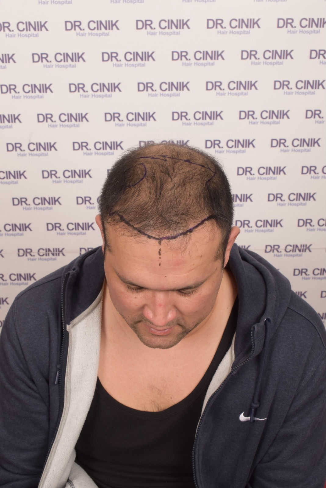 /foren/transplant/index.php/fa/54685/0/