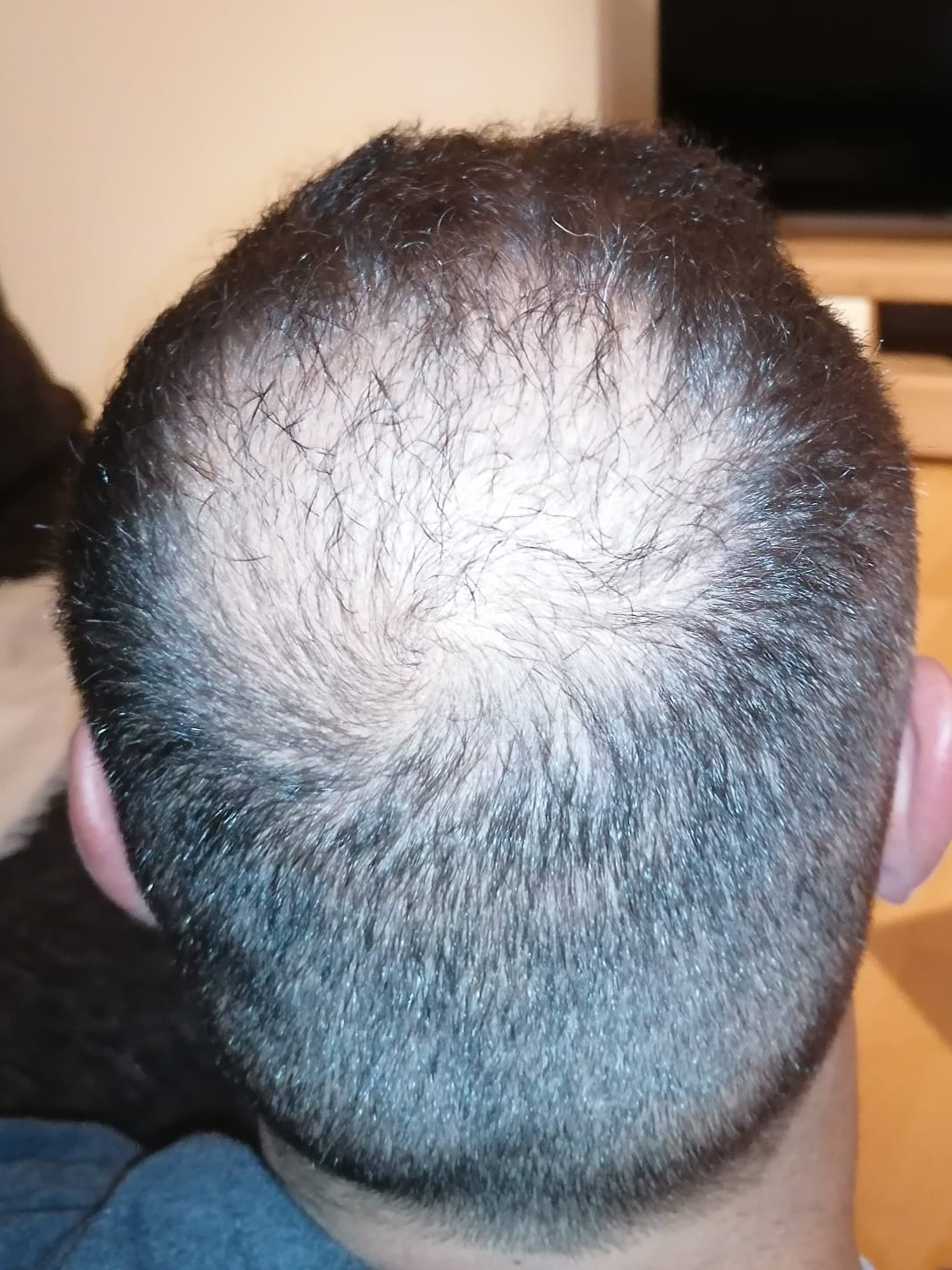 /foren/transplant/index.php/fa/54746/0/