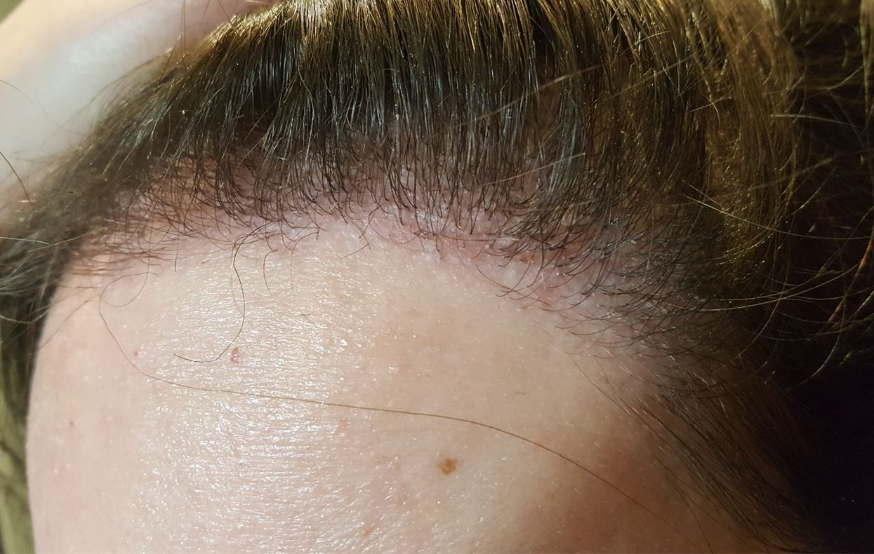 /foren/transplant/index.php/fa/54763/0/