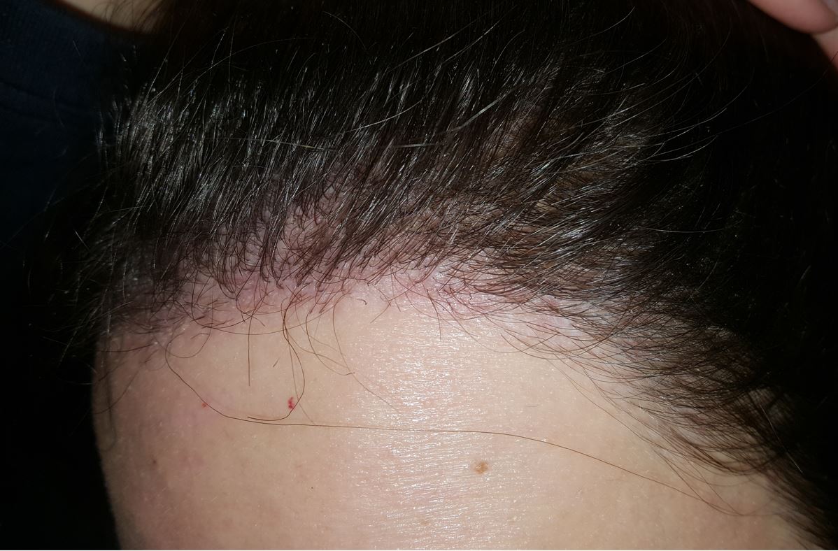 /foren/transplant/index.php/fa/54764/0/