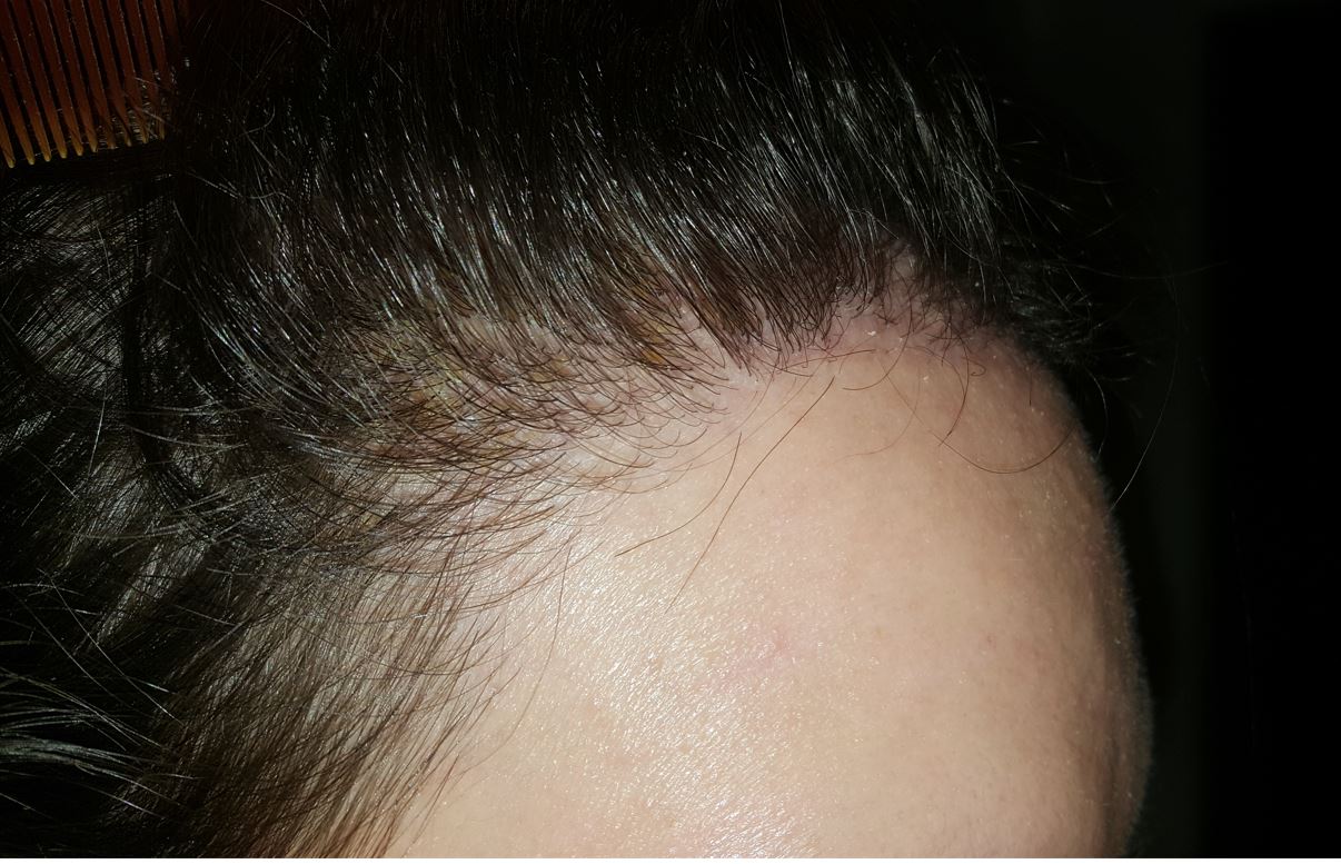 /foren/transplant/index.php/fa/54765/0/