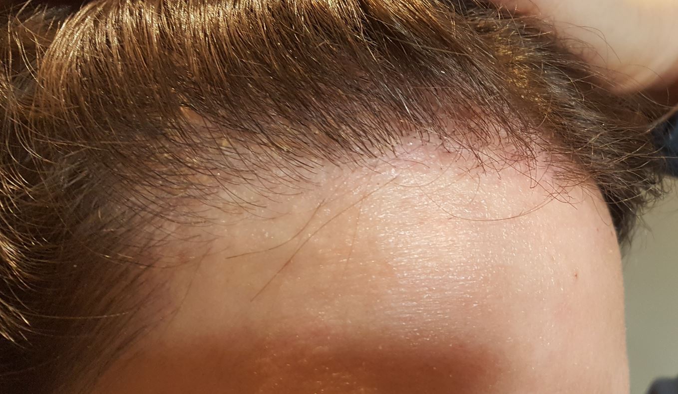 /foren/transplant/index.php/fa/54766/0/