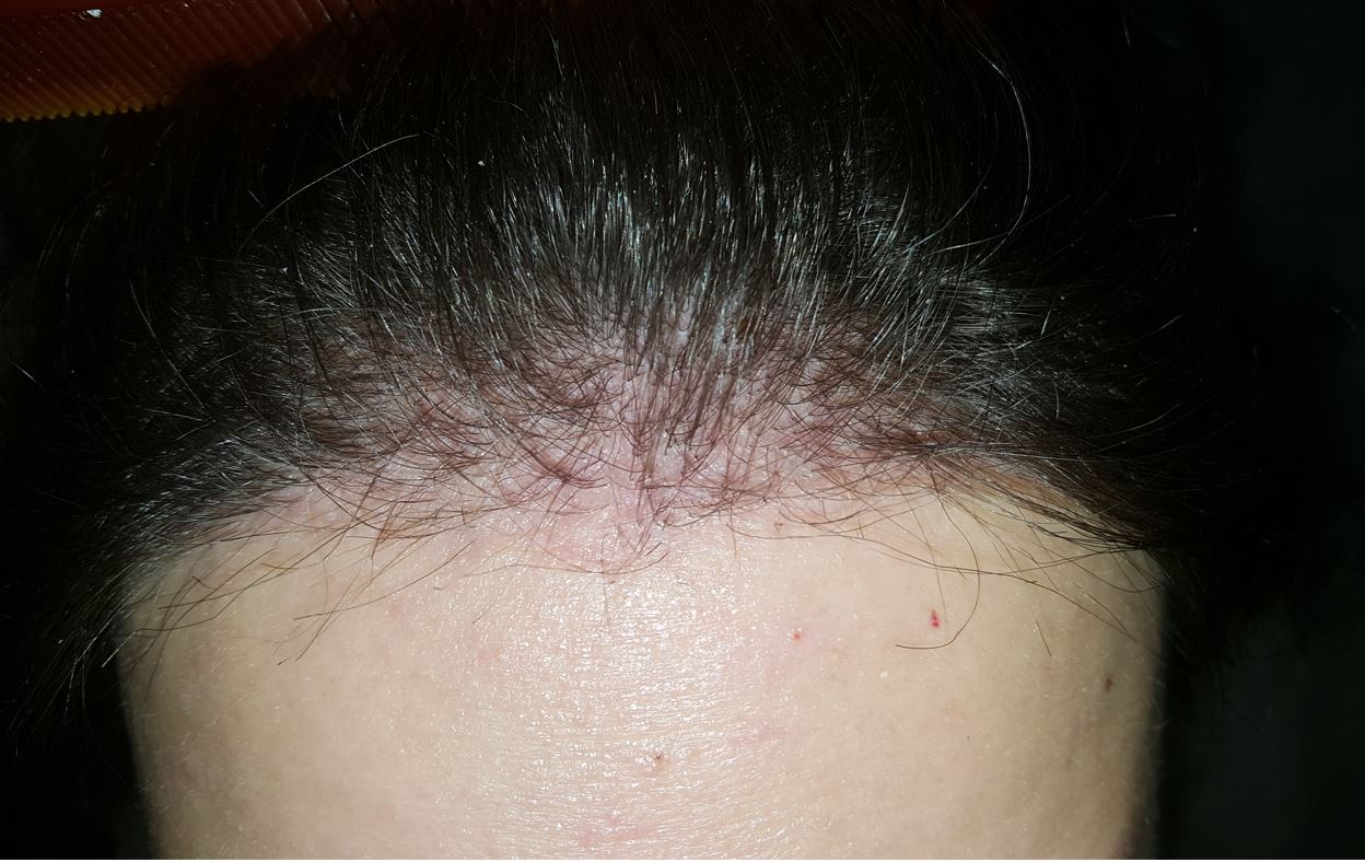 /foren/transplant/index.php/fa/54767/0/