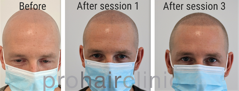 /foren/transplant/index.php/fa/54783/0/