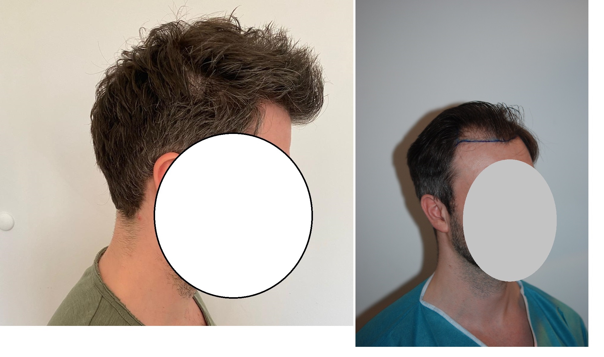 /foren/transplant/index.php/fa/54853/0/