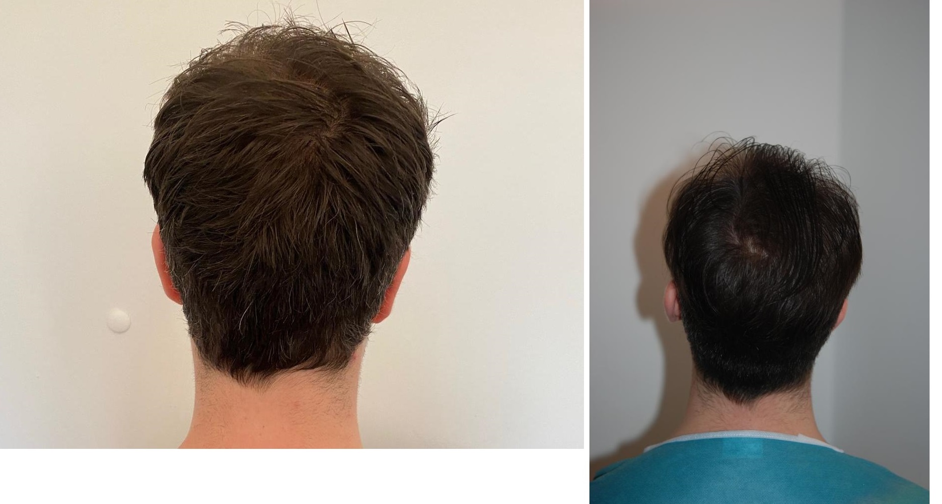 /foren/transplant/index.php/fa/54854/0/