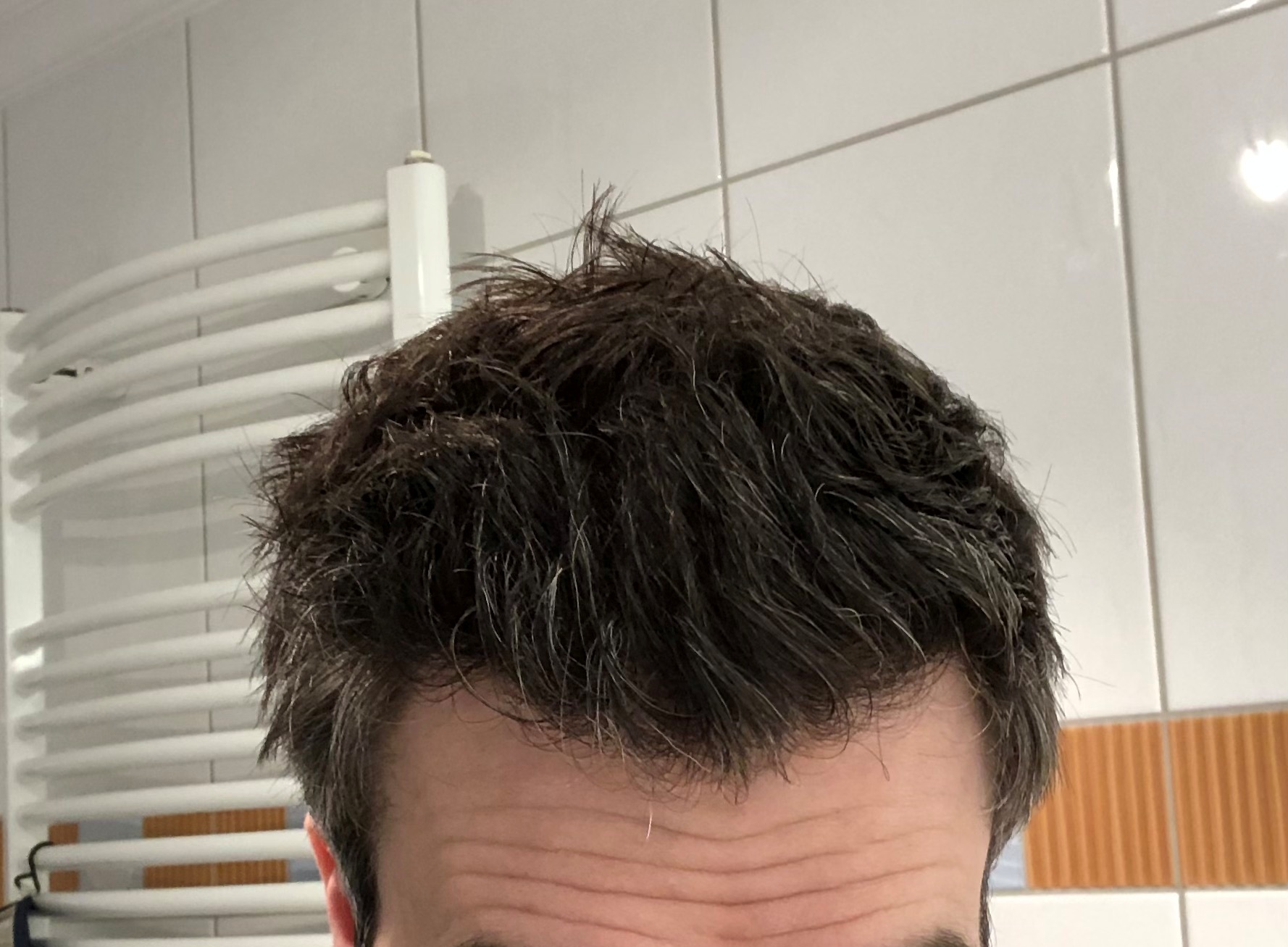 /foren/transplant/index.php/fa/54855/0/