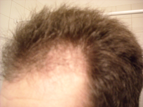 index.php/fa/5486/0/