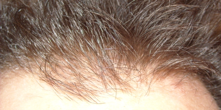 index.php/fa/5505/0/