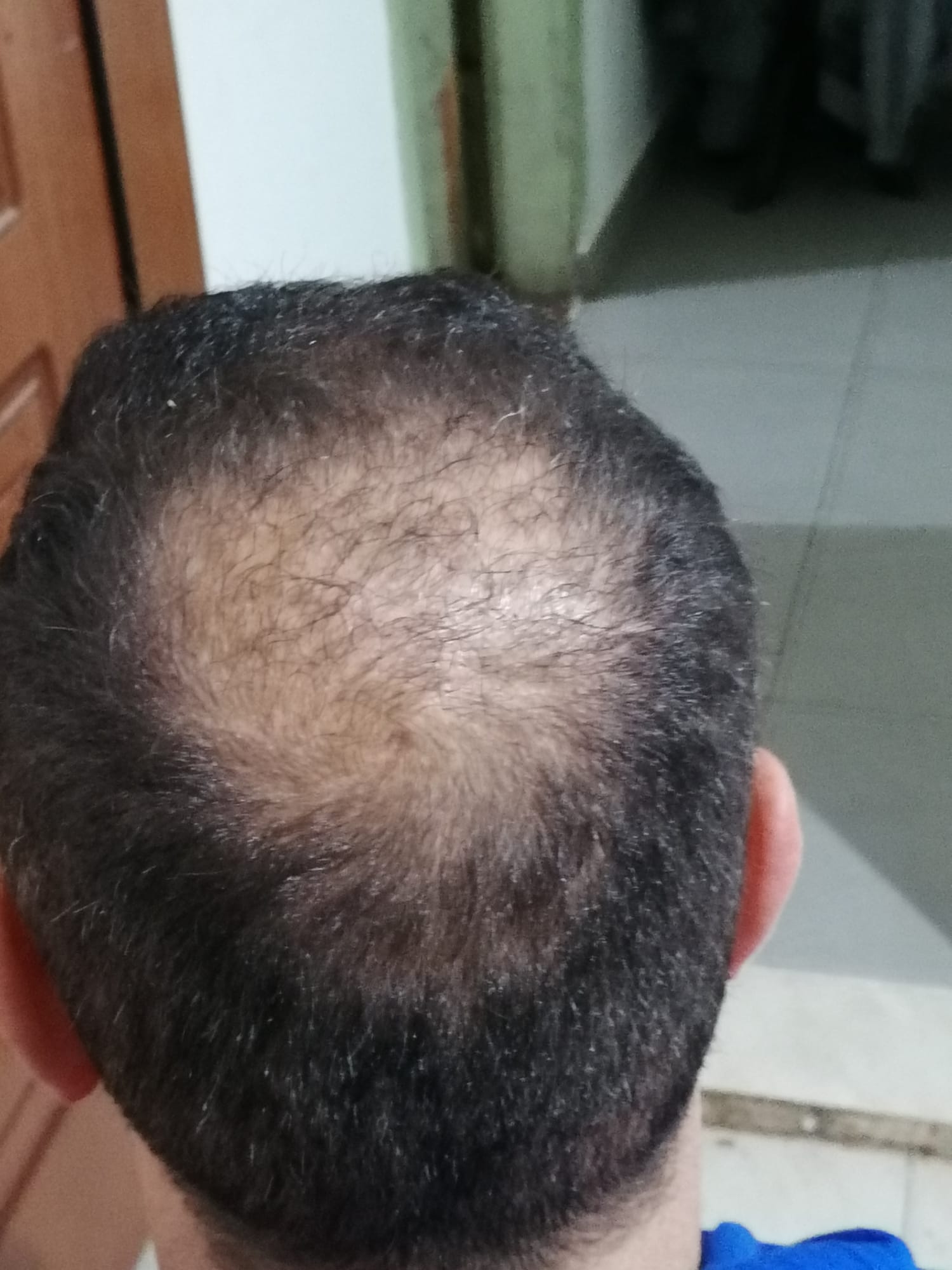 /foren/transplant/index.php/fa/55055/0/