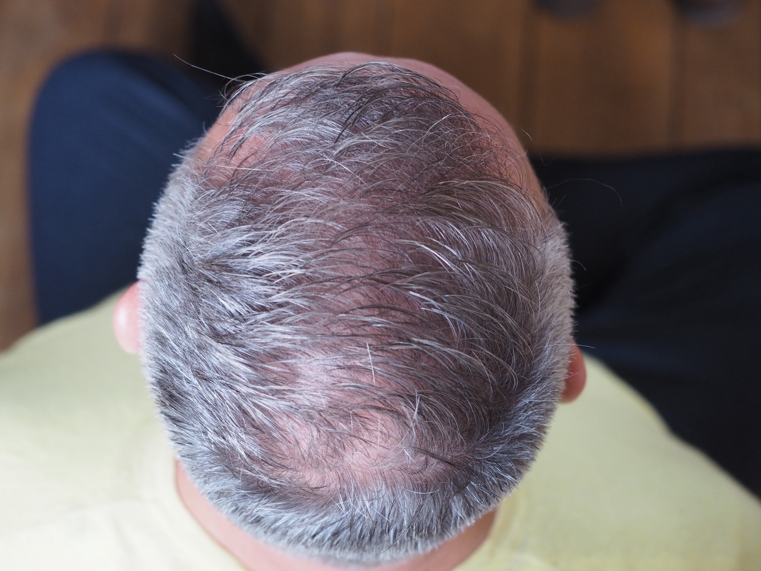 /foren/transplant/index.php/fa/55089/0/