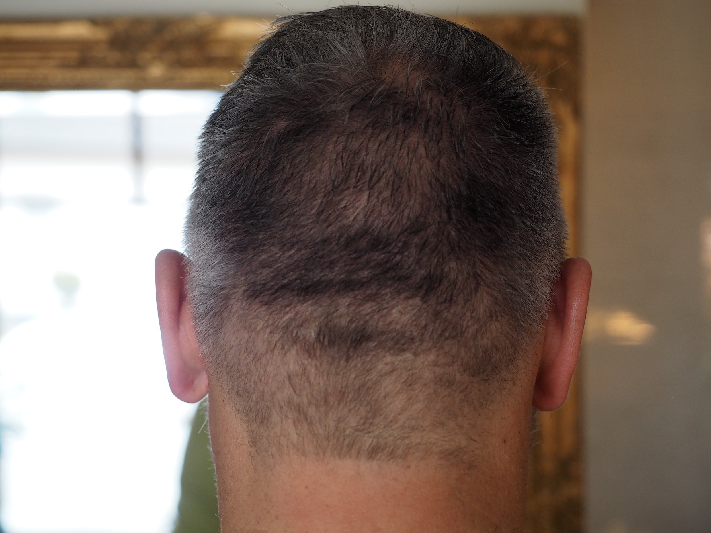 /foren/transplant/index.php/fa/55090/0/