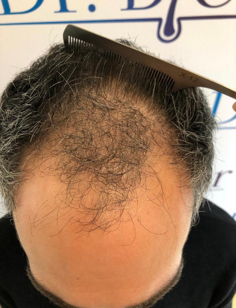 /foren/transplant/index.php/fa/55104/0/