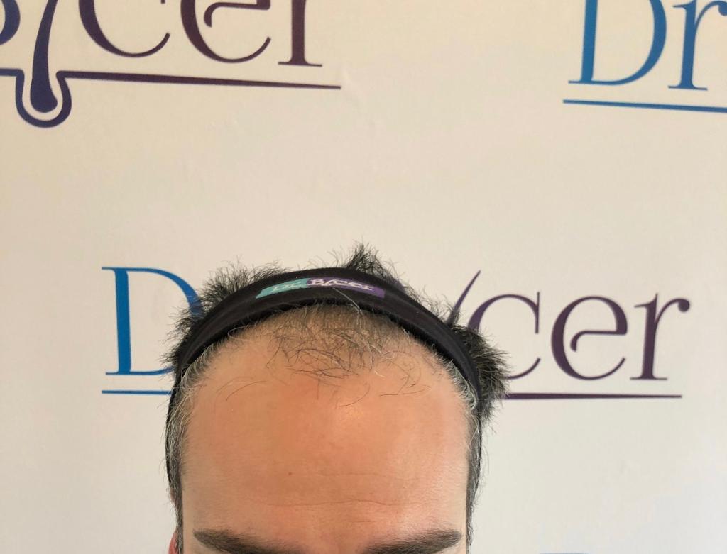 /foren/transplant/index.php/fa/55107/0/