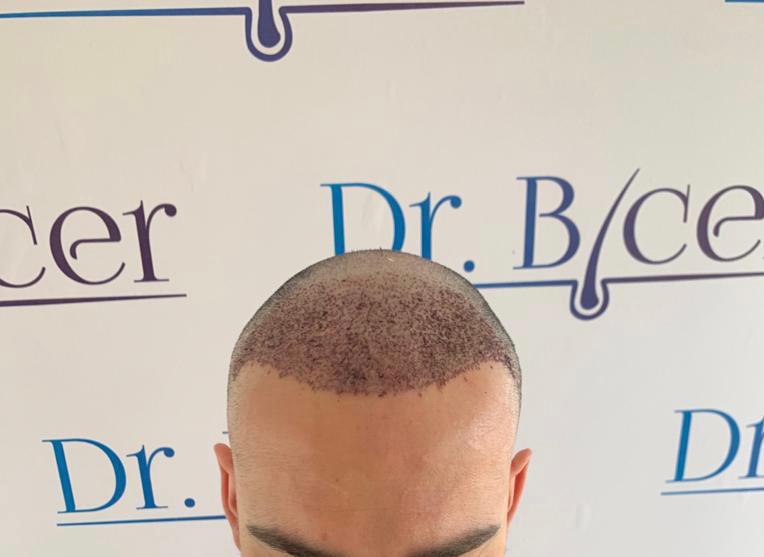 /foren/transplant/index.php/fa/55109/0/