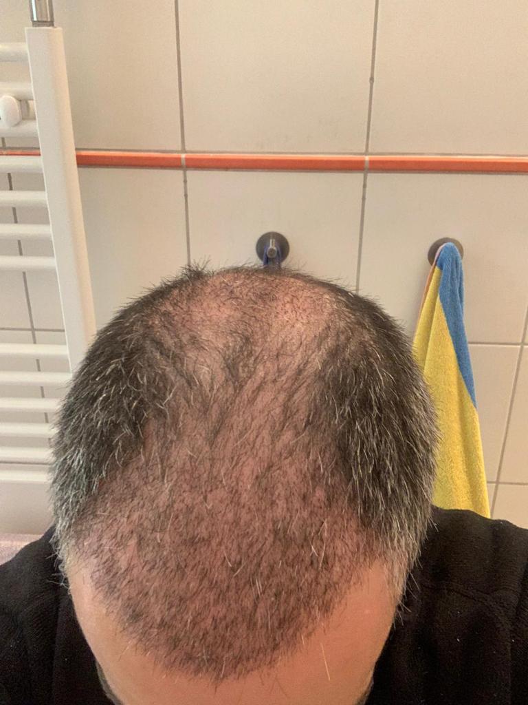 /foren/transplant/index.php/fa/55110/0/