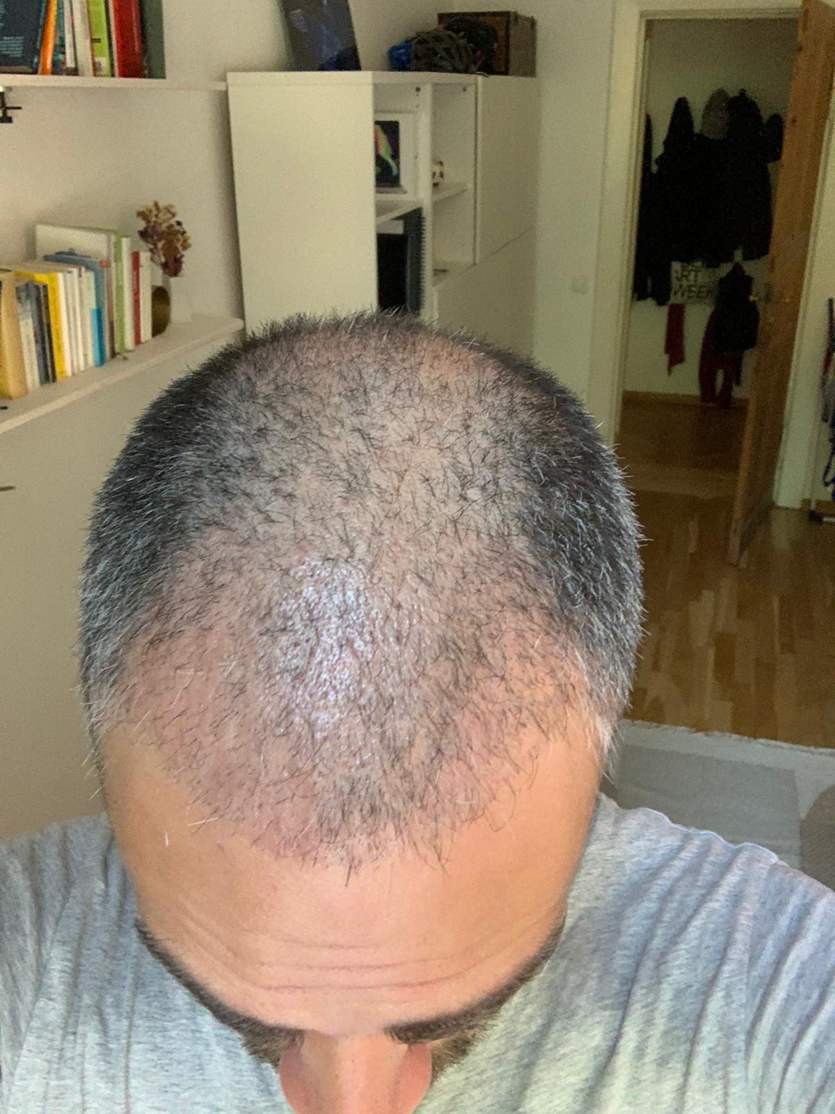 /foren/transplant/index.php/fa/55112/0/