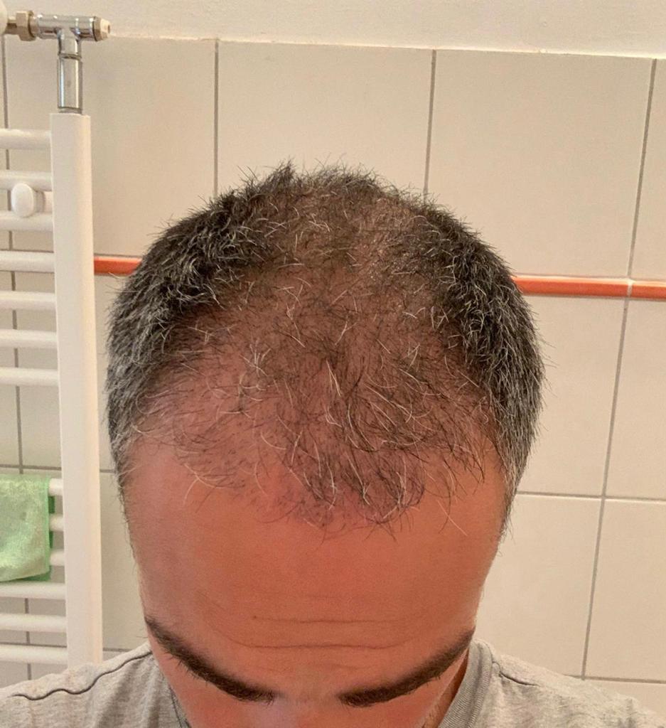 /foren/transplant/index.php/fa/55114/0/