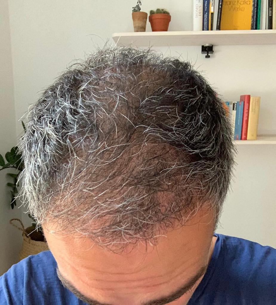 /foren/transplant/index.php/fa/55116/0/