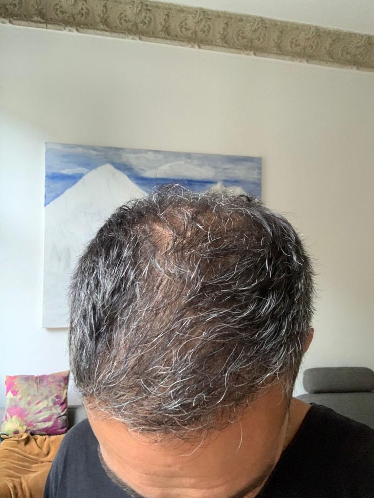 /foren/transplant/index.php/fa/55118/0/