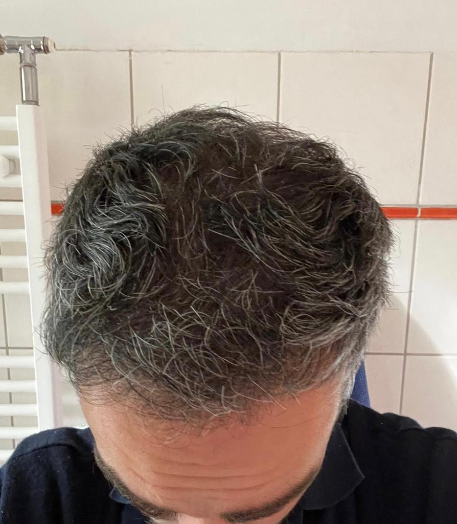 /foren/transplant/index.php/fa/55126/0/