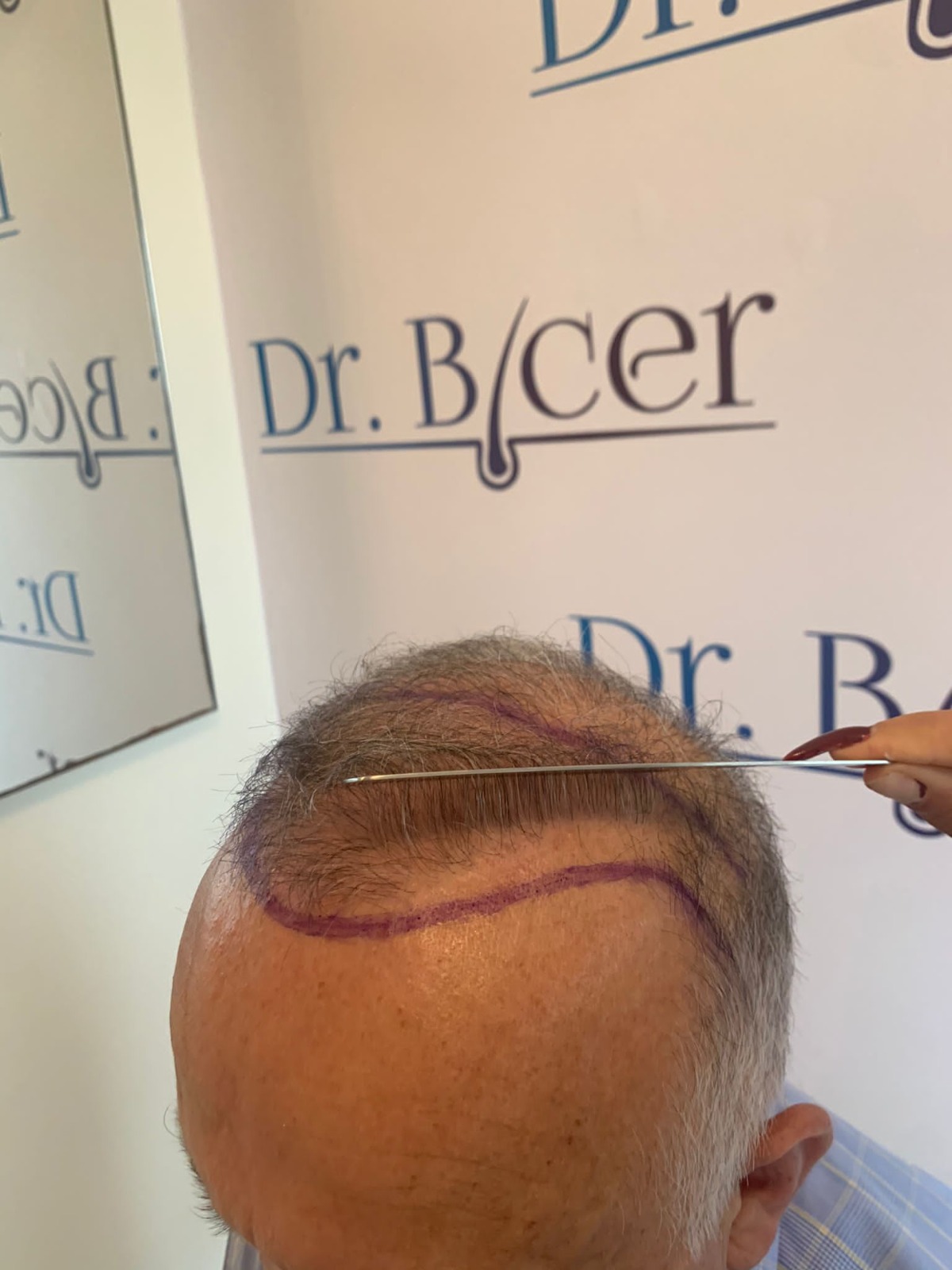 /foren/transplant/index.php/fa/55170/0/