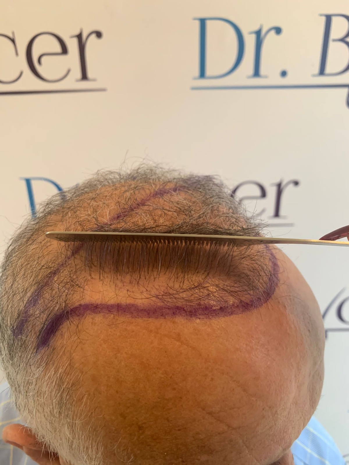 /foren/transplant/index.php/fa/55171/0/