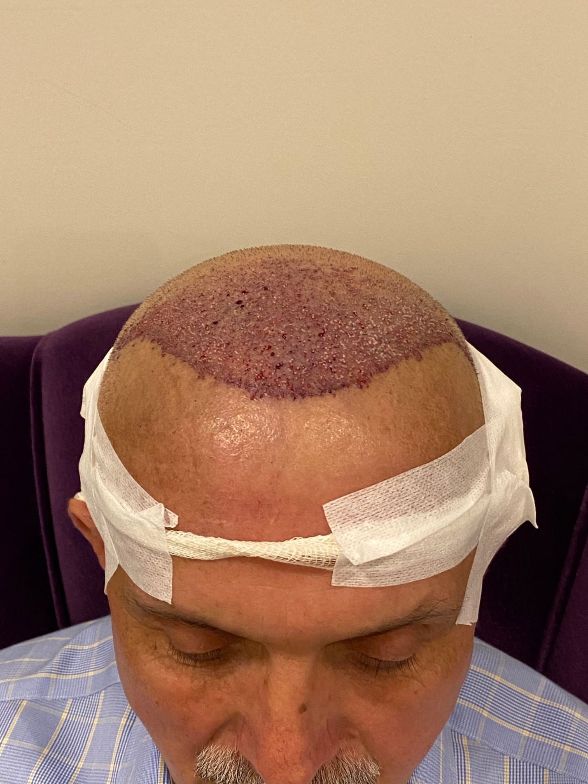 /foren/transplant/index.php/fa/55172/0/