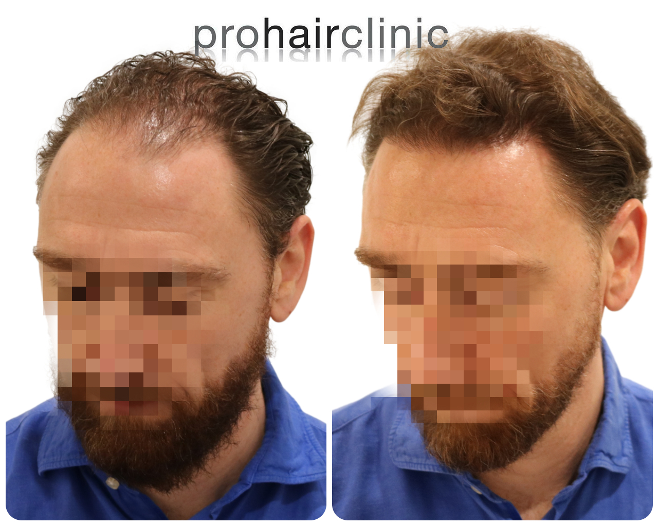 /foren/transplant/index.php/fa/55176/0/