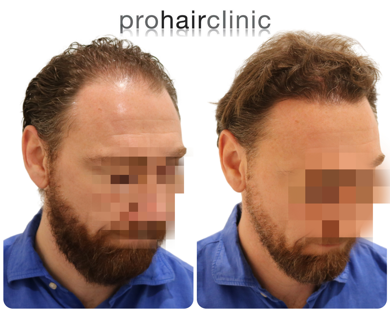 /foren/transplant/index.php/fa/55177/0/