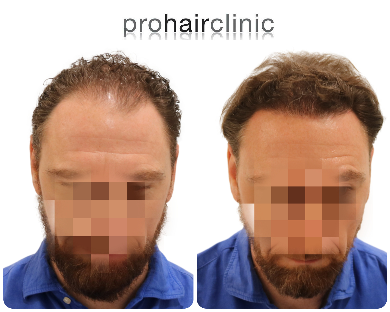 /foren/transplant/index.php/fa/55179/0/