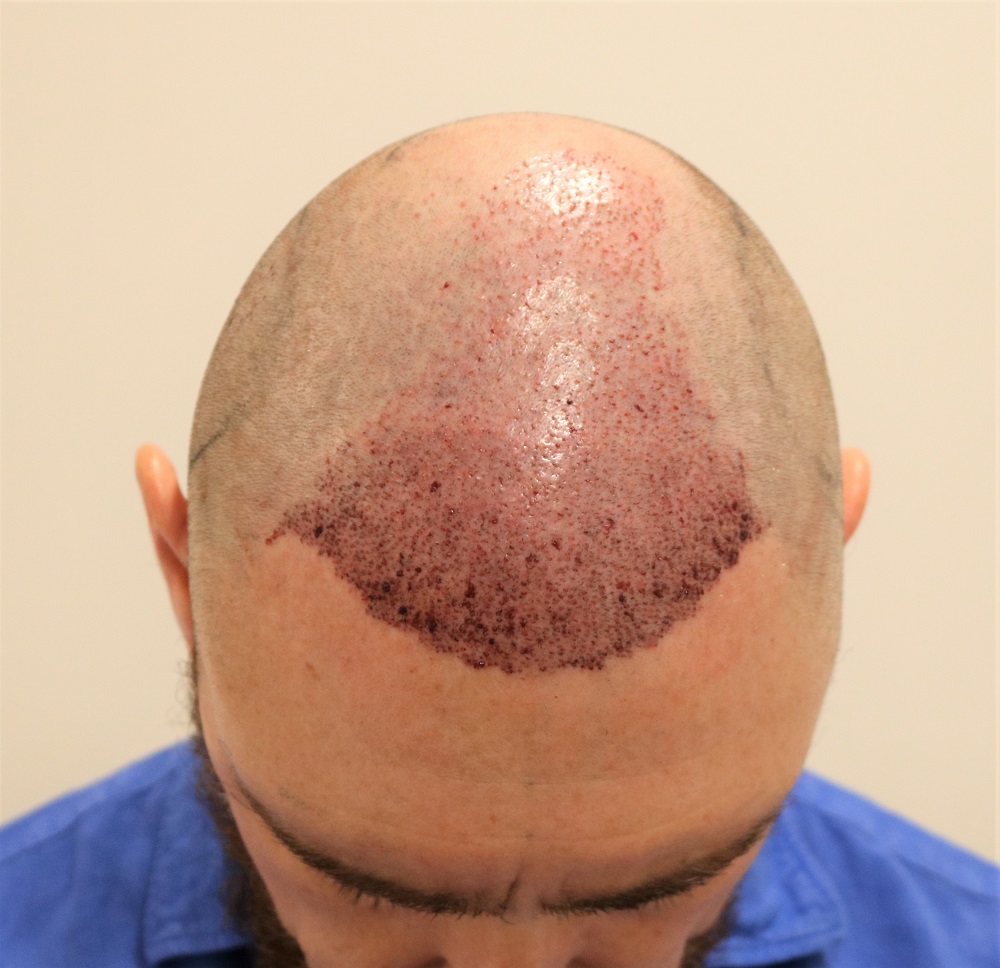 /foren/transplant/index.php/fa/55180/0/