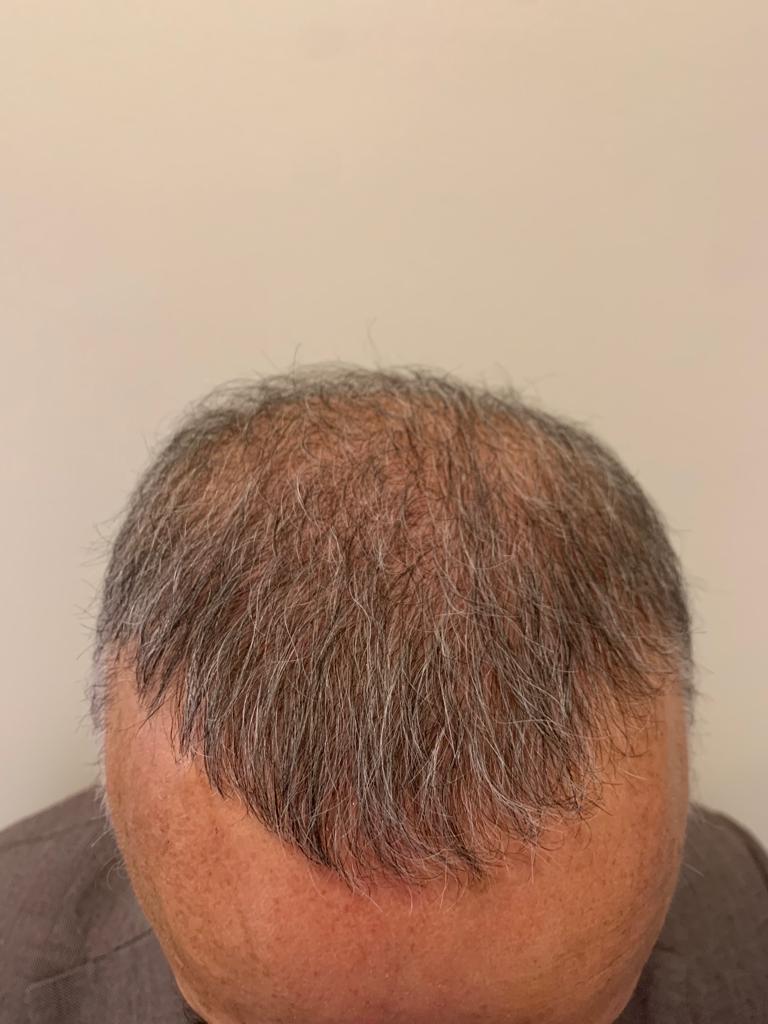 /foren/transplant/index.php/fa/55192/0/