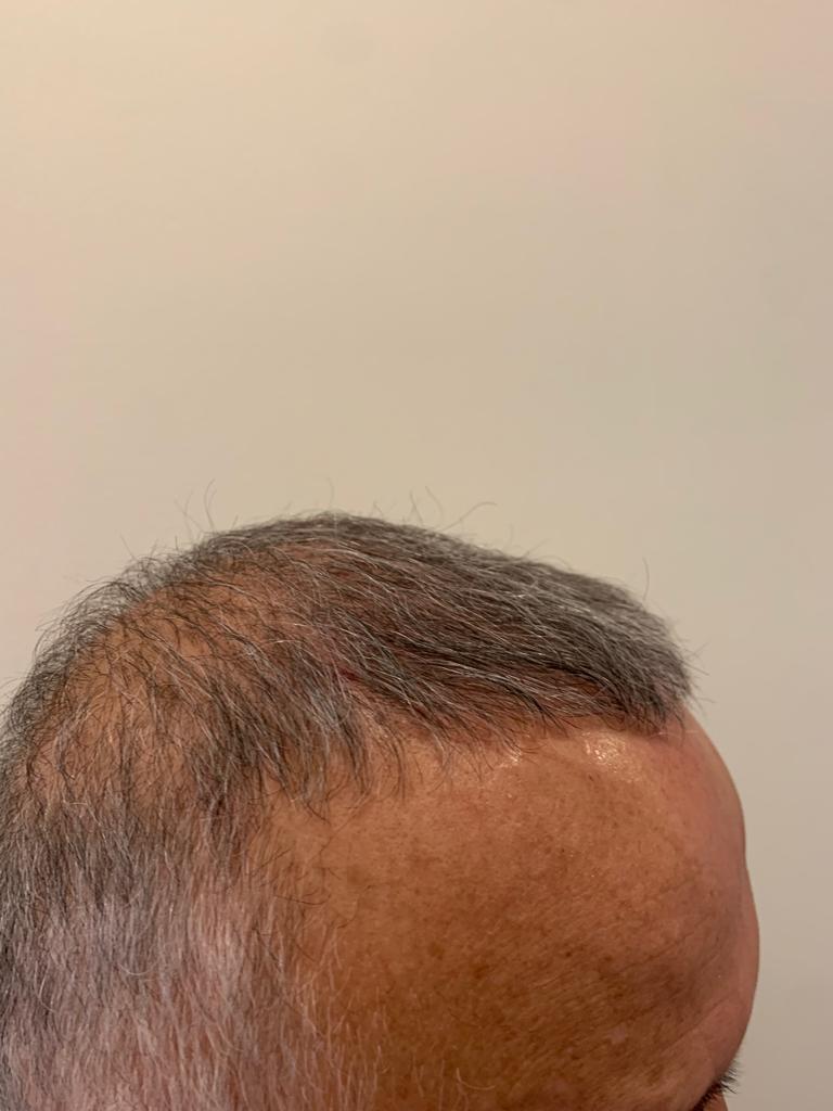 /foren/transplant/index.php/fa/55193/0/