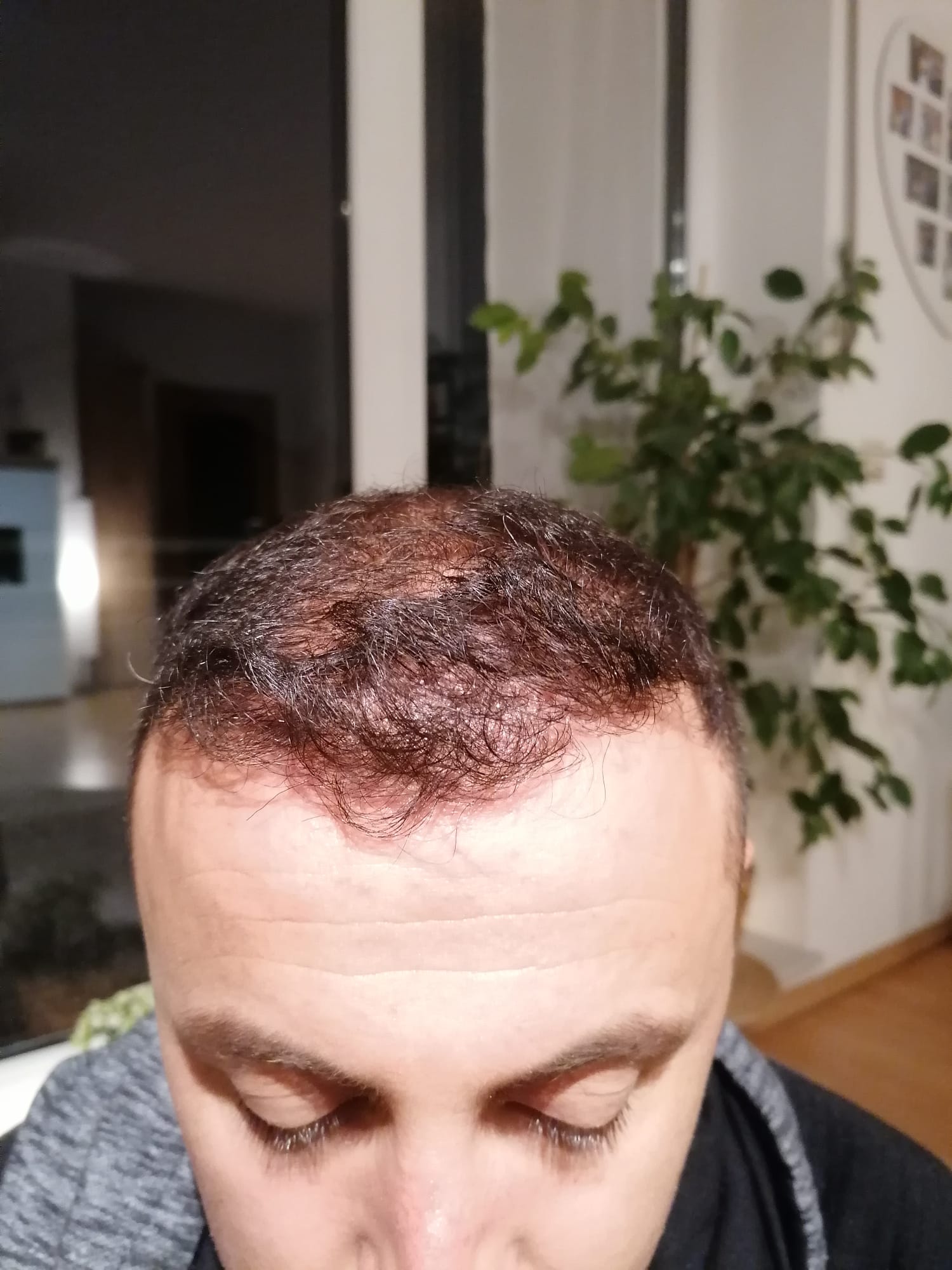 /foren/transplant/index.php/fa/55280/0/