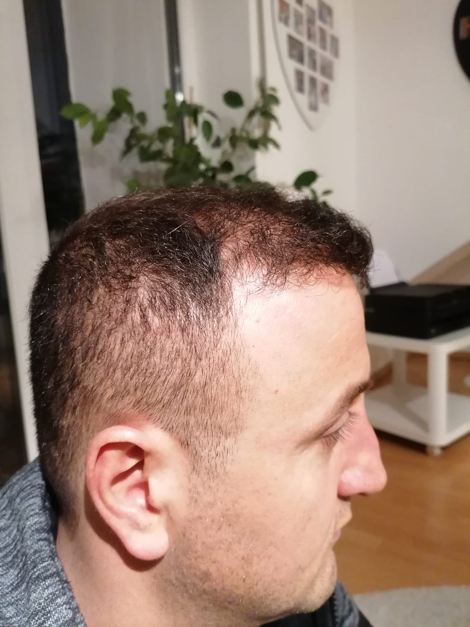 /foren/transplant/index.php/fa/55281/0/