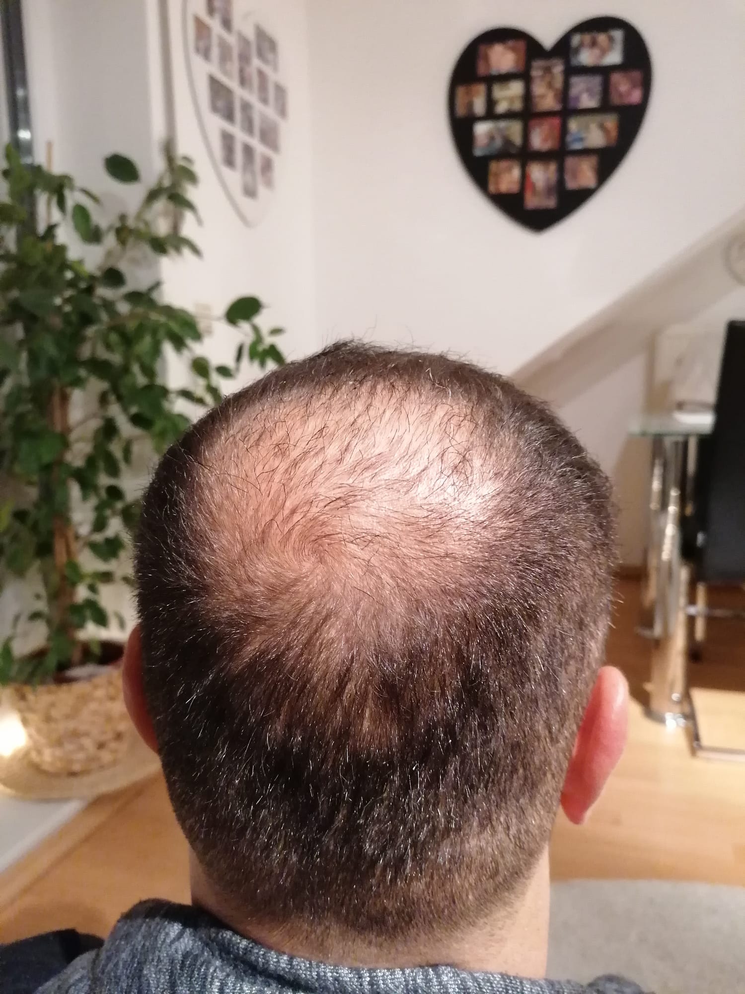 /foren/transplant/index.php/fa/55282/0/