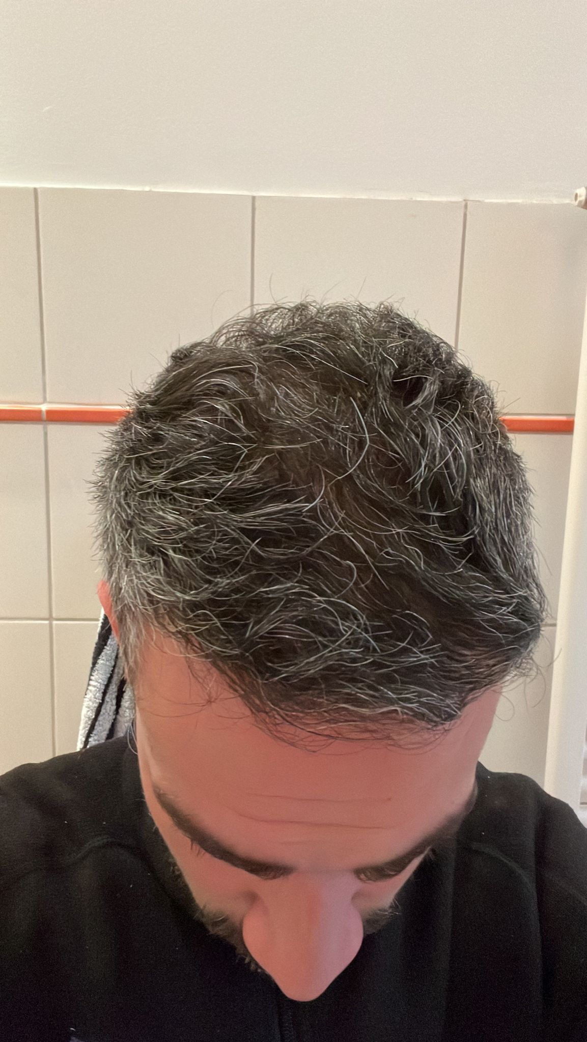 /foren/transplant/index.php/fa/55294/0/