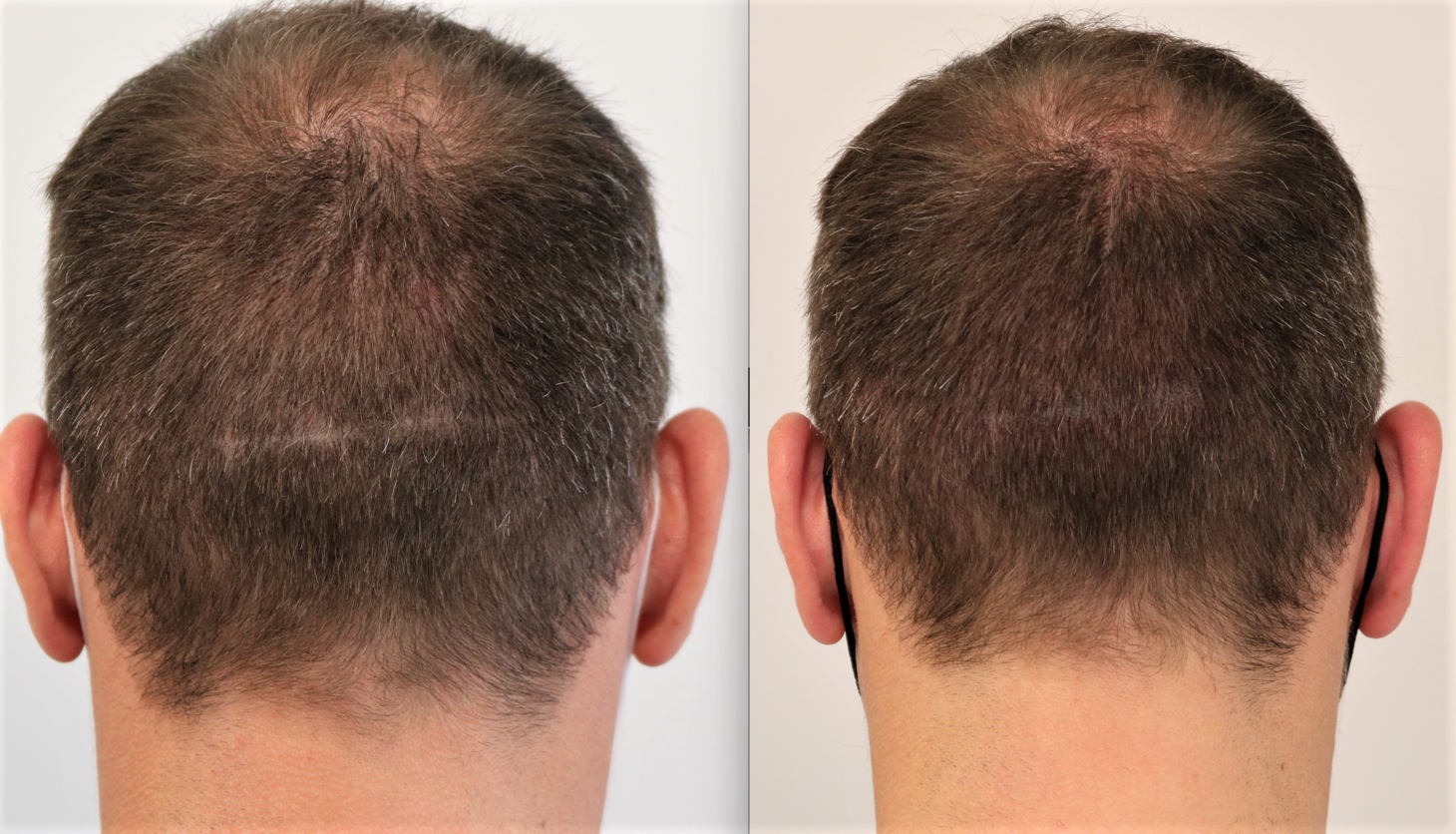 /foren/transplant/index.php/fa/55379/0/