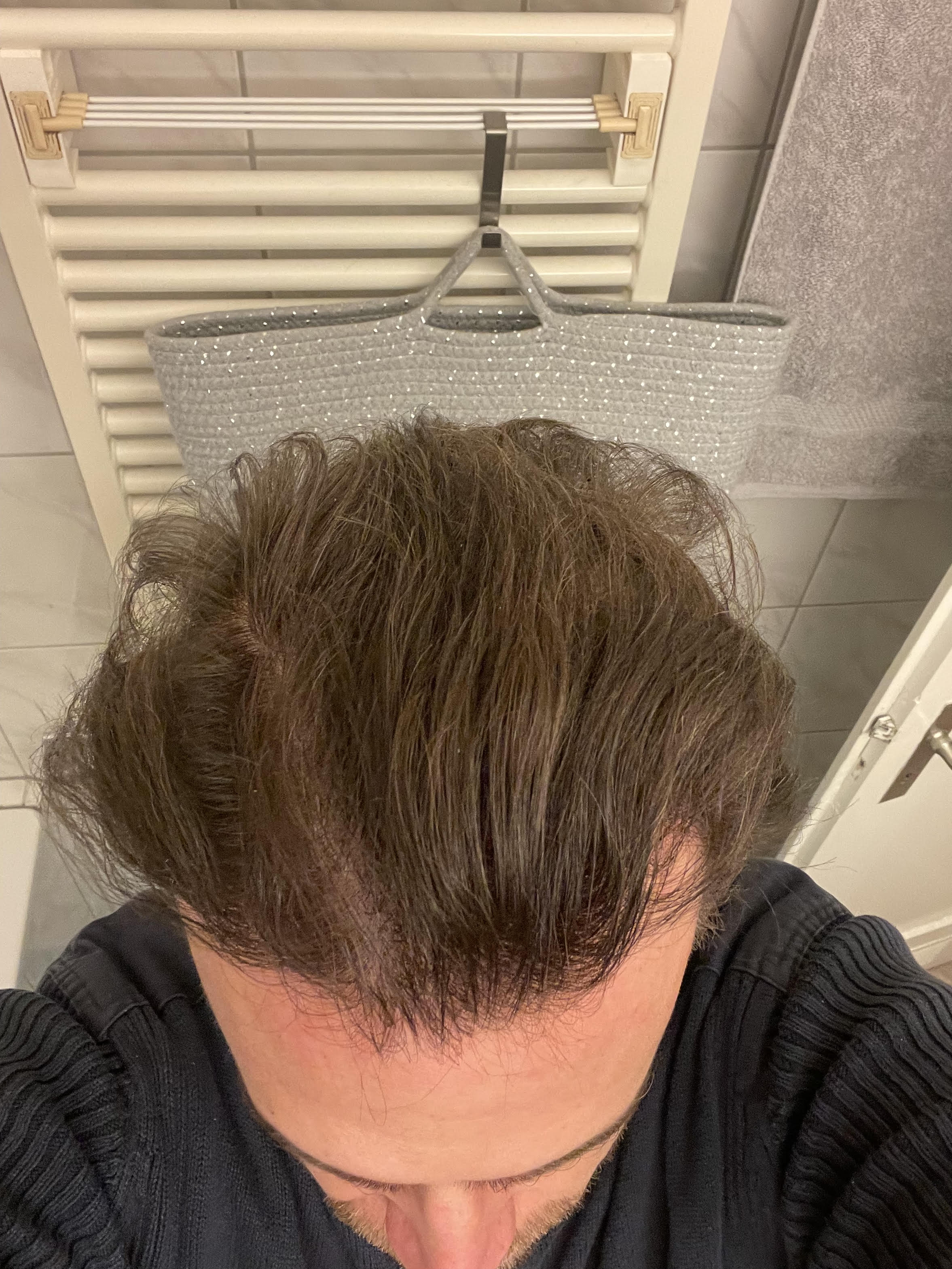 /foren/transplant/index.php/fa/55383/0/