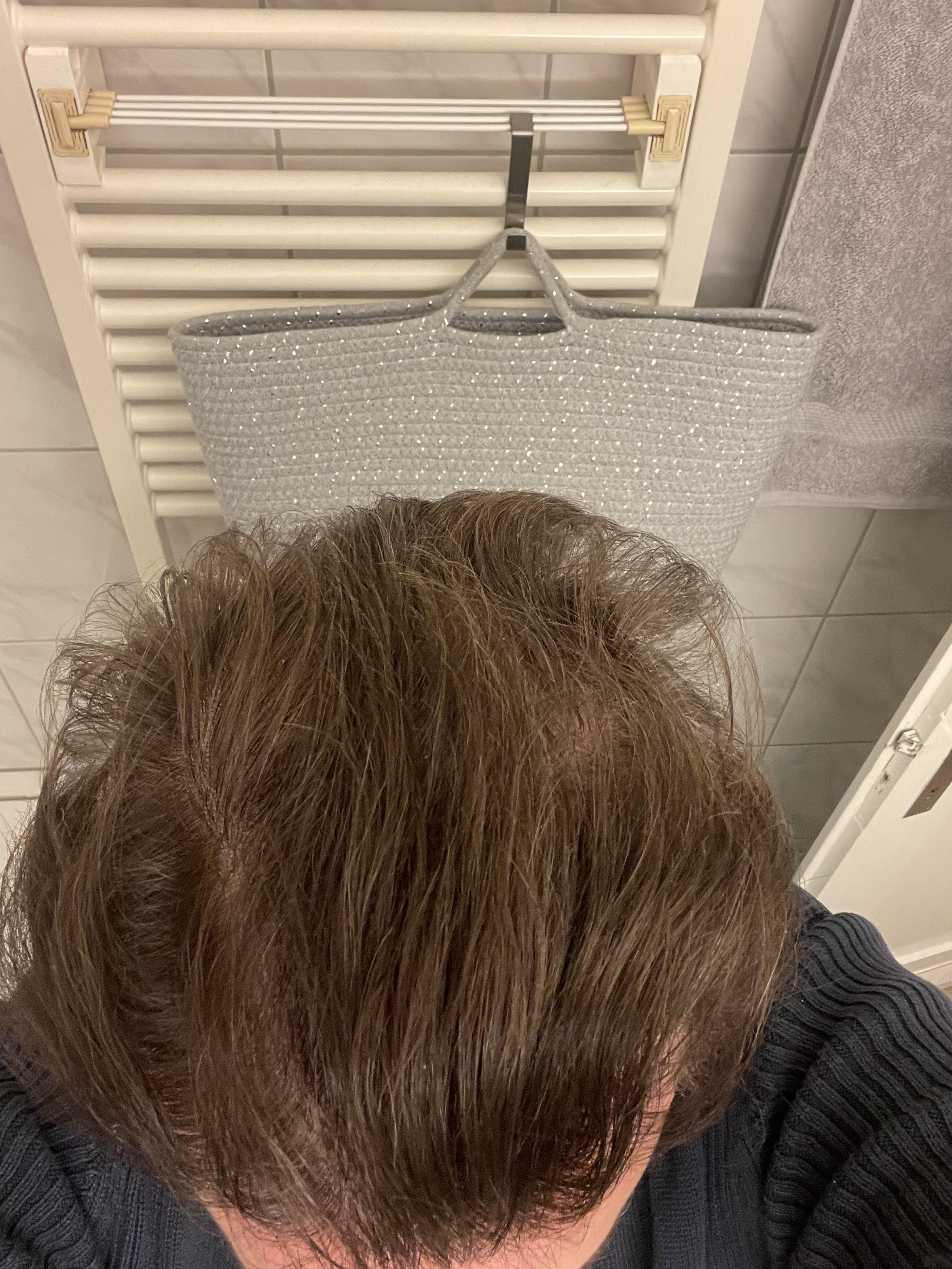 /foren/transplant/index.php/fa/55384/0/