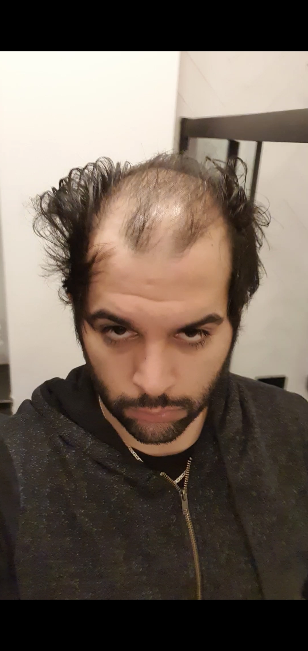 /foren/transplant/index.php/fa/55391/0/